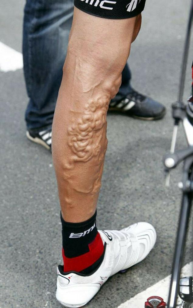 16. Fransa Bisiklet Turu sonrası bacağının durumunu paylaşan George Hincapie: