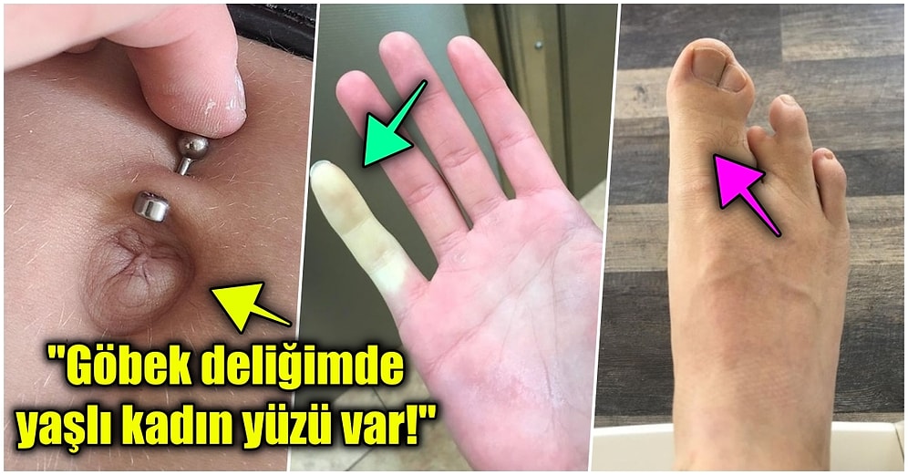 Vücutlarındaki Eşsiz Özelliklerle Diğer İnsanlardan Ne Kadar Farklı Olduklarını Gözler Önüne Seren 15 Kişi