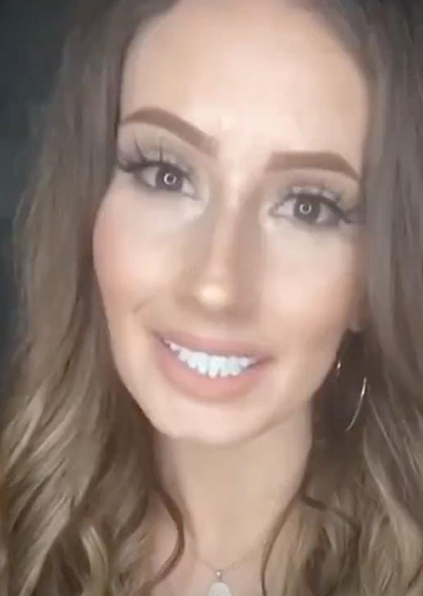 Genç kadın, hamilelikten sonra kaybettiği dişlerine yaptırdığı protezle hayatına devam ettiğini gösteren videoları sosyal medya hesabında paylaşıyor.