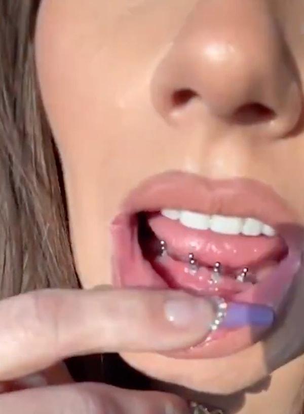 2 milyondan fazla takipçisi olan Alicia, takipçileriyle takma diş kullanımıyla ilgili eğitici ve eğlenceli videolarını paylaşıyor.