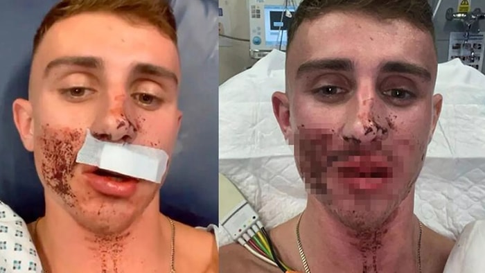 Олимпийского спортсмена по тхэквондо избили на улицах Дублина