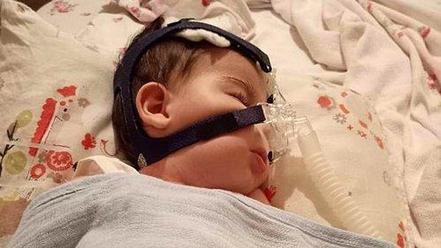 Ülkemizde ne yazık ki binlerce SMA hastası bebek ve çocuk var. Ve bu özel çocukların aslında her birimizin yardımına ihtiyacı var.