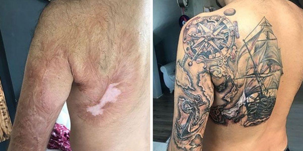 18 случаев, когда тату мастера помогли людям покрыть шрамы с помощью татуировок