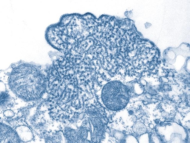 Nipah virüsü hayvanlardan insanlara geçen bir virüs türü ve insanlara sadece hayvanlar aracılığıyla değil, hem virüsün bulaştığı yiyecekler hem de virüse yakalanan diğer insanlardan da geçebiliyor.