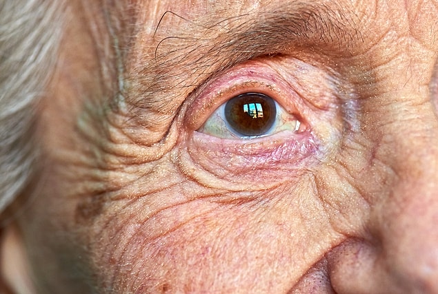 Alzheimer hastalığı, hem dünya hem de Türkiye nüfusunun yaşlanmasıyla birçok kişide görülebiliyor.
