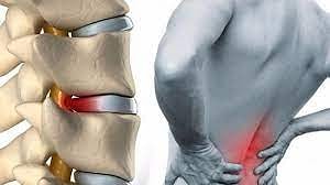 Kulunc Nedir Kulunc Agrisi Nasil Gecer