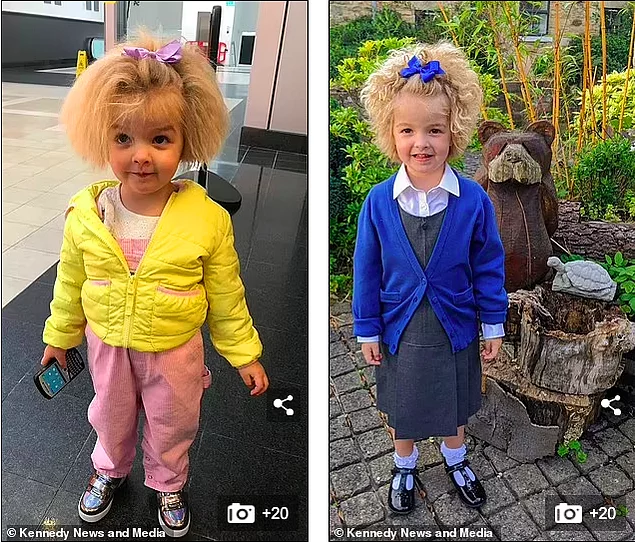 У 6-летней девочки тот же синдром, что у Эйнштейна, из-за чего ее волосы невозможно расчесать