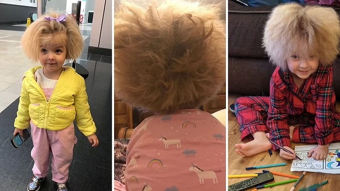 У 6-летней девочки тот же синдром, что у Эйнштейна, из-за чего ее волосы невозможно расчесать