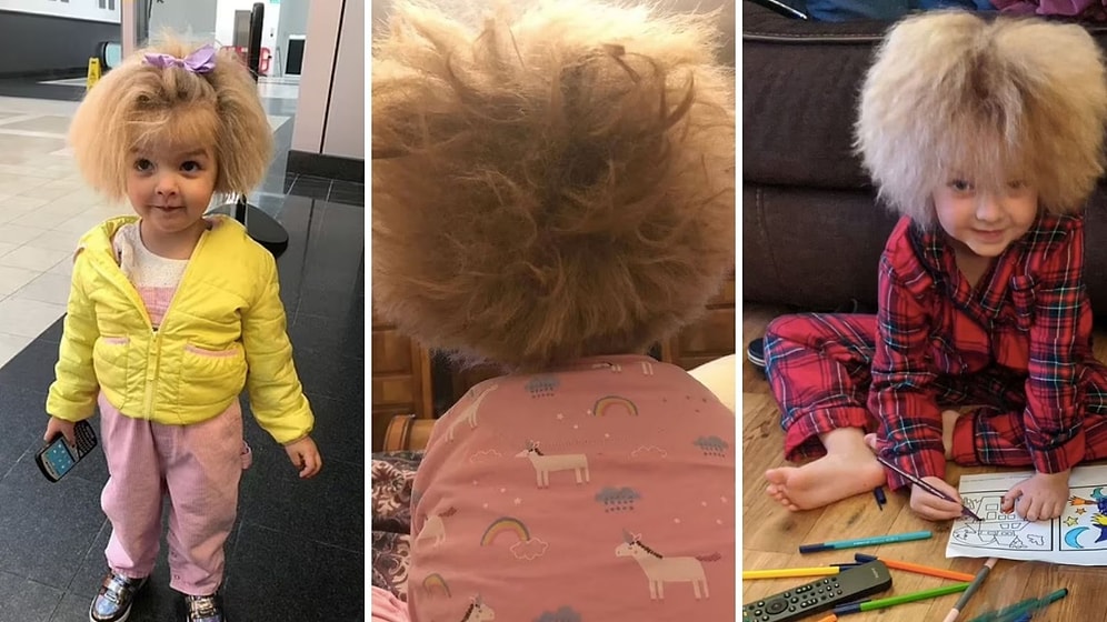 У 6-летней девочки тот же синдром, что у Эйнштейна, из-за чего ее волосы невозможно расчесать