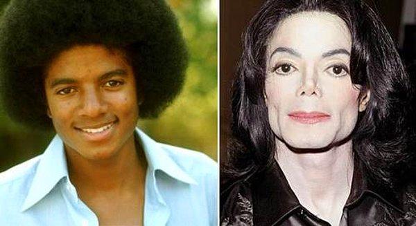 4. Pop müziğin kralı Micheal Jackson, hepimizin bildiği estetik operasyonları için tam 1.000.000$ harcamış