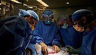 Американские хирурги успешно трансплантировали свиную почку человеку