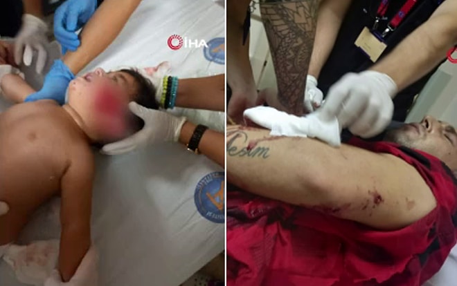 Antalya’da Pitbull Cinsi Köpek 11 Aylık Bebeğin Yanağını ve Kulağını Kopardı