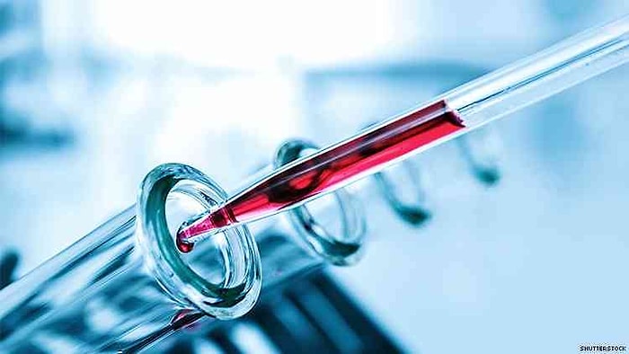 AST: Aspartat Aminotransferaz Nedir? Yüksekliği ve Düşüklüğü Ne Anlama Gelir? Değerleri Kaç Olmalıdır?