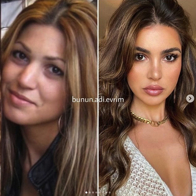 8. Blogger Negin Mirsalehi'nin yaptırdığı küçük dokunuşlar ne kadar da doğal görünüyor...