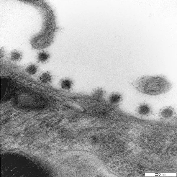 Основные симптомы включают головную боль, боль в горле, насморк и высокую температуру.