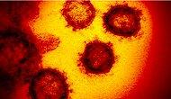 Научный центр "Вектор" впервые опубликовал фотографии дельта-штамма коронавируса
