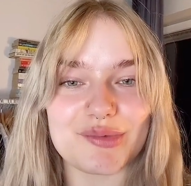 TikTok'ta normalde de yaptırdığı dudak dolgusu gibi işlemleri takipçileriyle paylaşan Nikita sonucundan memnun olmadığı işlem hakkında şunları söyledi: