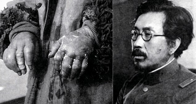 2. Shiro Ishii