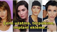 Estetiklerce! Çene Ameliyatıyla Yepyeni Bir Çehreye Sahip Olan 15 Ünlü