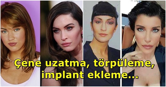 Estetiklerce! Çene Ameliyatıyla Yepyeni Bir Çehreye Sahip Olan 15 Ünlü