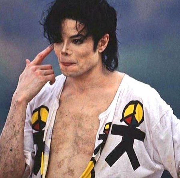 5. Michael Jackson'ın vitiligo olduğunu gösteren şimdiye dek çekilmiş en detaylı fotoğraf: