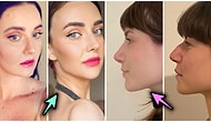 16 Shocking Transformations of Beautiful Women Turning Into Completely Different People After Plastic Surgery!