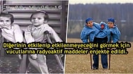 Bilim Adı Altında Acımasız İşkencelere Maruz Kalmış Yapışık İkizlerin Yürek Burkan Hikayesi