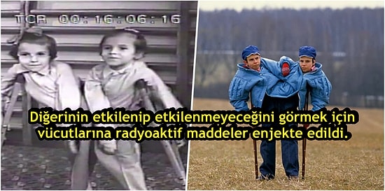 Bilim Adı Altında Acımasız İşkencelere Maruz Kalmış Yapışık İkizlerin Yürek Burkan Hikayesi