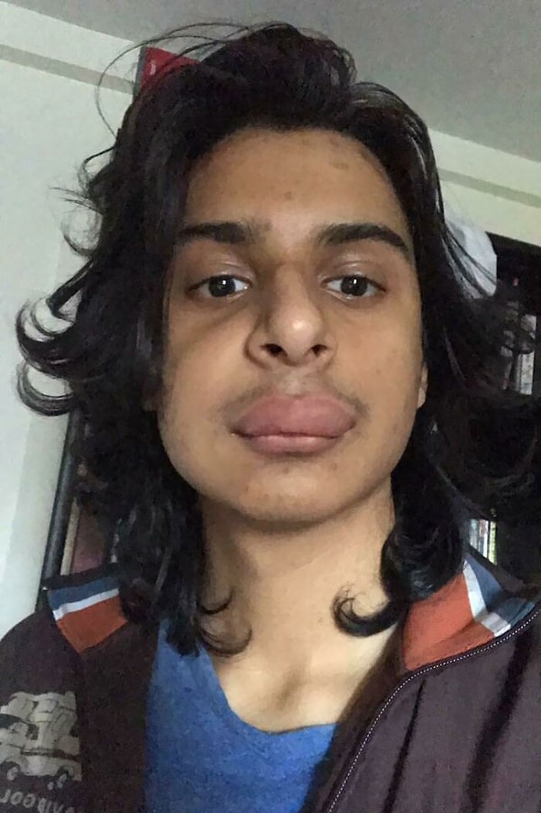 19. Сегодня у меня собеседование, а меня ужалила оса. Я даже не могу правильно говорить