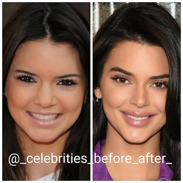 7. Кендалл Дженнер