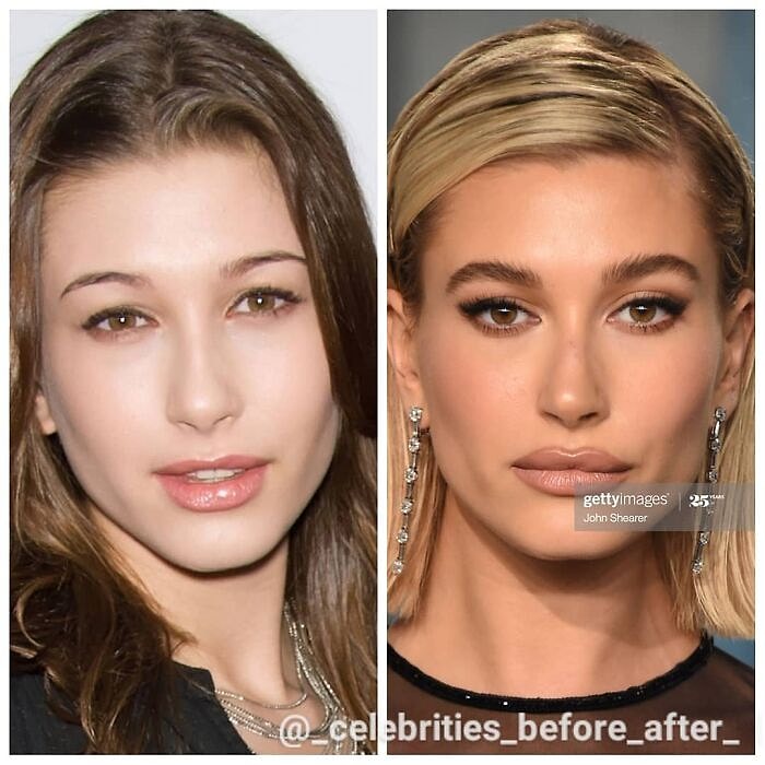 30 пар фотографий, показывающих, как с годами изменились знаменитости (Ну, и без пластики не обошлось)