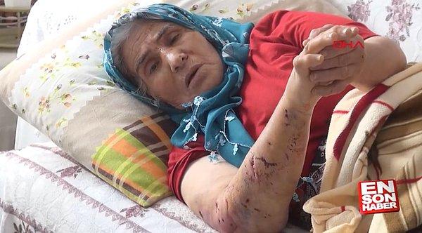 3. Tokat'ta, ziyarete gittiği komşusunu evinde bulamayan Hatice Er (68), geri dönerken sahipsiz bir köpeğin saldırısıyla elinden, kolundan ve sırtından yaralandı.