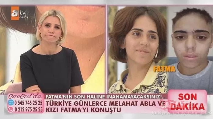 Esra Erol'da Fatma'nın Son Hali Yürek Burktu: Esra Erol'da Fatma Kimdir, Ne Olmuştu?