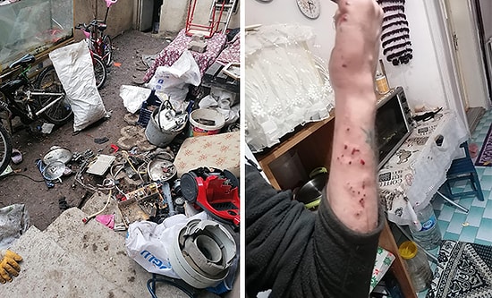 Elinde Patladı: 'Hurda' Diye Aldığı Malzemeler Bomba Fünyesi Çıktı