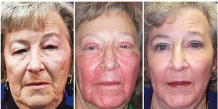 Kendimize Sarmadan Duramadık! 2021’de Tercih Edilen Estetik Trendleri