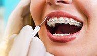 Ortodonti Nedir? Hangi Hastalıklara Bakar?