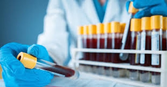 Hastane Tahlil Sonucu Nasıl ve Nereden Öğrenilir? e-Nabız Tahlil Sonucu Nasıl Öğrenilir?