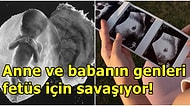 Araştırmacılar, Cinsiyetler Savaşının Daha Anne Karnında Başladığını Keşfetti