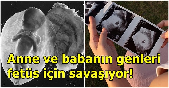 Araştırmacılar, Cinsiyetler Savaşının Daha Anne Karnında Başladığını Keşfetti