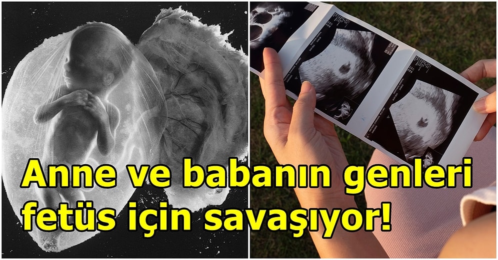 Araştırmacılar, Cinsiyetler Savaşının Daha Anne Karnında Başladığını Keşfetti