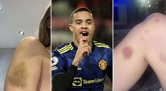 Manchester'ın Yıldızı Mason Greenwood Tutuklandı! Greenwood Ne Yaptı, Neden Tutuklandı? İşte O Görüntüler...