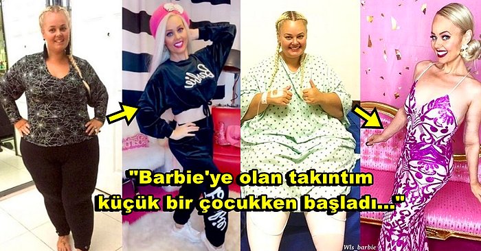 Barbie Bebeğe Benzeyebilmek İçin Midesinin %80'lik Kısmını Aldırarak Değişimiyle Herkesi Şaşkına Çeviren Kadın