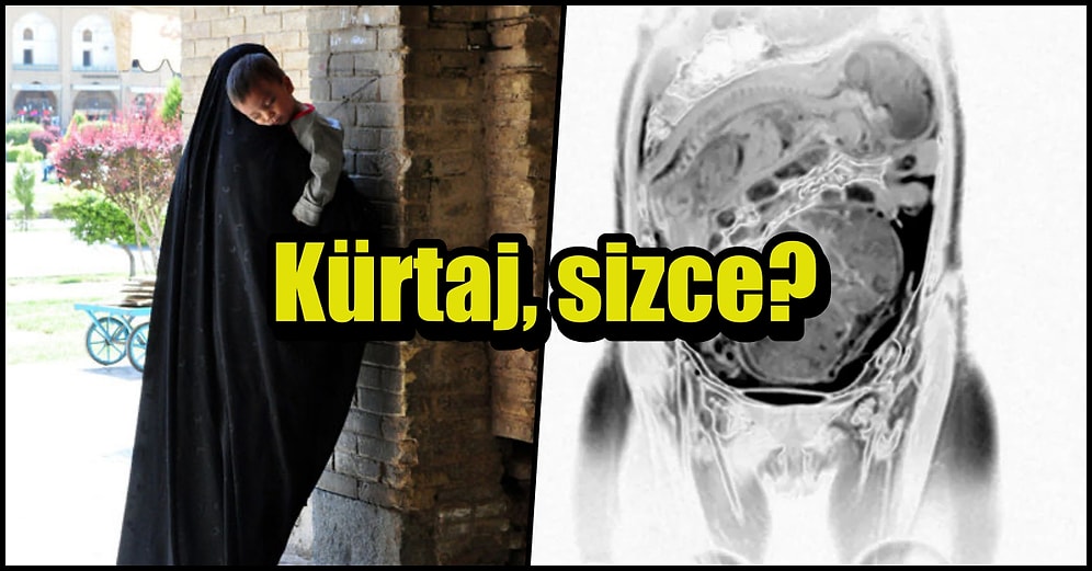 Mucize Bebek: İranlı Bir Kadın, Bağırsağının Üstünde Büyüttüğü Bebeği Dünyaya Getirdi