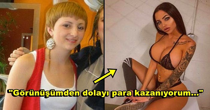 Zamanında 'Çirkin' Diye Dalga Geçiyorlarmış: Bir Servet Harcayarak Tanınmayacak Hale Gelen OnlyFans Modeli