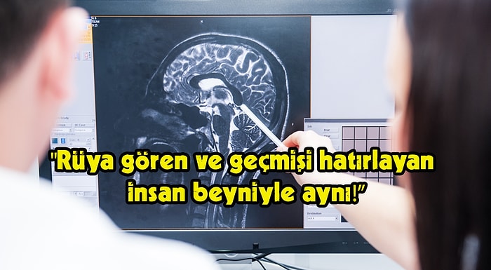 Hayatını Kaybeden Bir İnsanın Beyin Aktiviteleri Bilim İnsanları Tarafından İlk Kez Görüntülendi!