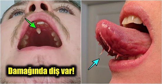 Diğer İnsanlardan Kolayca Ayırt Edilebilen Kendilerine Has Özellikleriyle Görenleri Şaşkına Çeviren 29 Kişi