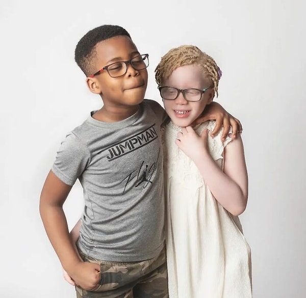 «По мере того, как дни складывались в недели, я начала задаваться вопросом, как их воспримет общество. В Африке над альбиносами издеваются и не обращаются с ними по-доброму, поэтому я забеспокоилась».