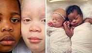 Женщина родила близнецов с разным цветом кожи, и подумала, что ей вручили не того ребенка