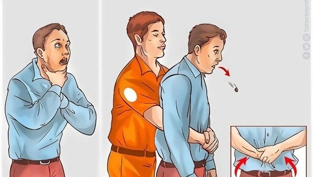 Heimlich Manevrası Nedir, Nasıl Uygulanır? Heimlich Manevrası Hangi Durumlarda Yapılır?