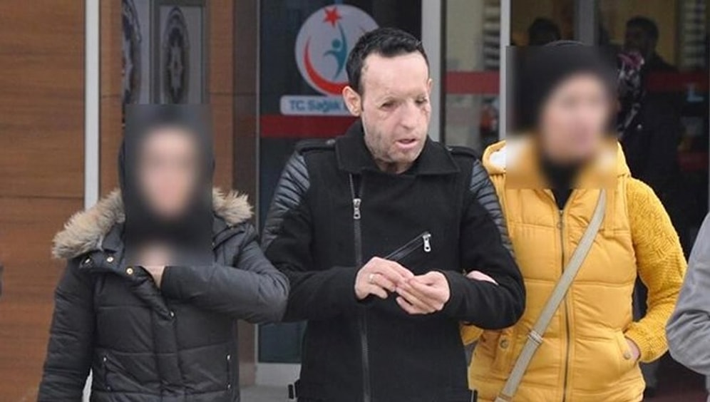 Yüz Nakli Yapılan Recep Sert Uyuşturucudan Gözaltına Alındı